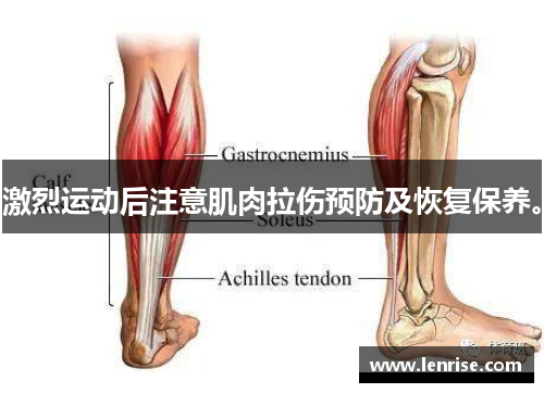 激烈运动后注意肌肉拉伤预防及恢复保养。